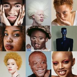 Love black preta pretinha brasileira brazilian retinta black darkl vitiligo albinismo pose foto  ...
