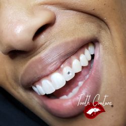 Tooth Couture Tooth Gems & Teeth Whitening