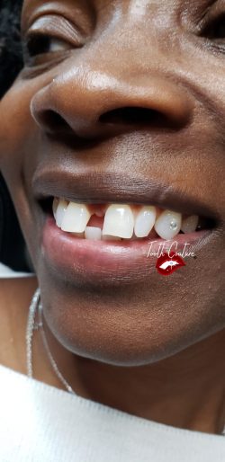 Tooth Couture® Tooth Gems & Teeth Whitening