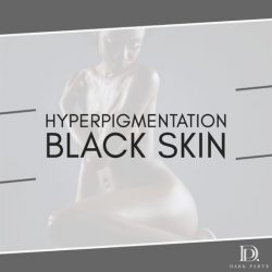 Hyperpigmentation Black Skin