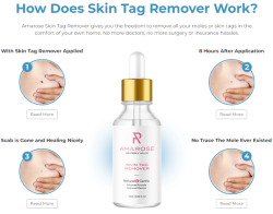 Amarose Skin Tag Remover Reviews – Advanced Skin Tag Removal Scam?