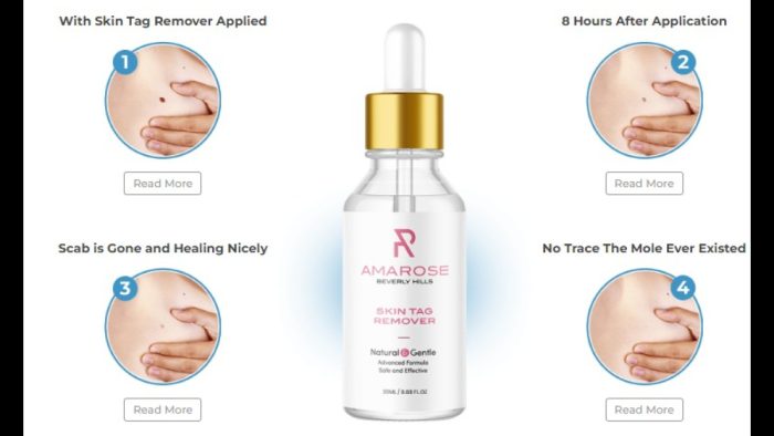 Amarose Skin Tag Remover Review (SCAM Warning!) Know This Now!