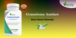 What Home Remedies Should Apply for Granuloma Annulare Natural Treatment